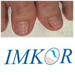 IMKOR